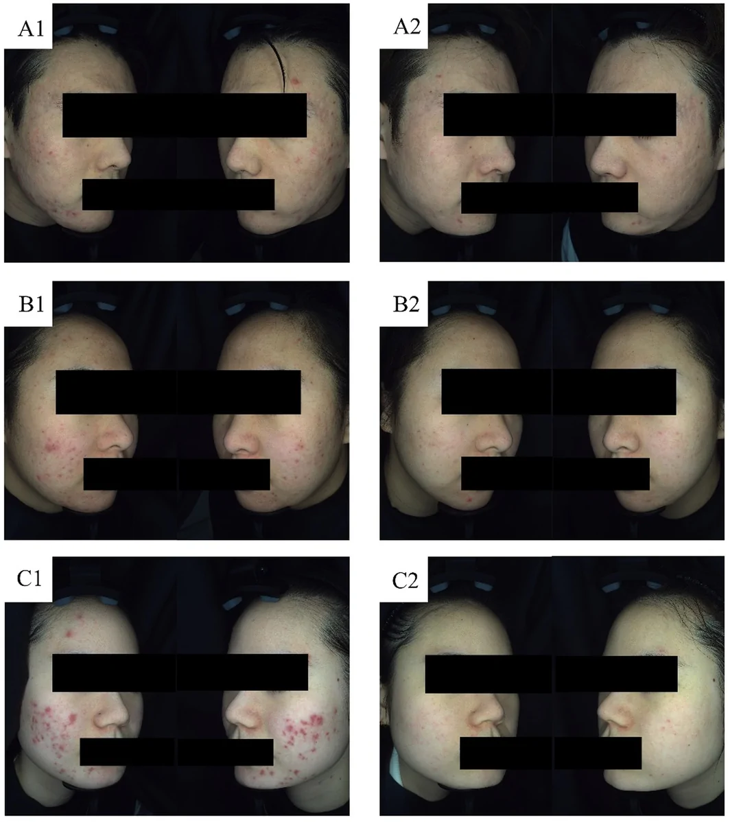 FIGURE 3